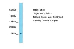 MZT1 Rabbit anti-Human, Polyclonal, Novus Biologicals 0.1ml; Unconjugated:Antibodies,